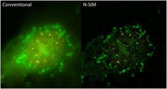 新光学显微镜技术揭示活细胞生物历程